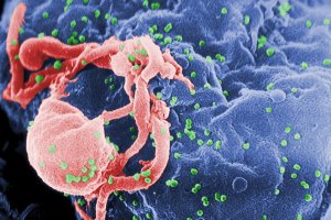 Во Франции зафиксирован первый в истории случай долгосрочной ремиссии ВИЧ без лечения